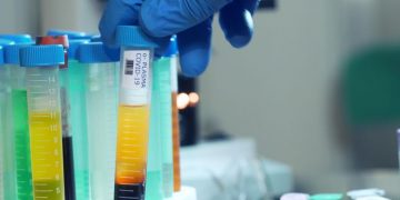 BNPB: “Call Center” Plasma Konvalesen untuk Calon Donor, Bukan untuk Pencari Plasma