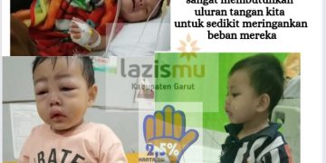 LAZISMU Garut : Adil, Balita yang sedang Berjuang untuk Sembuh dari Hisprung