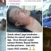 Viral Kabar Pj Bupati Brebes Kena Cacar Monyet Mpox, Benarkah? Cek Faktanya!